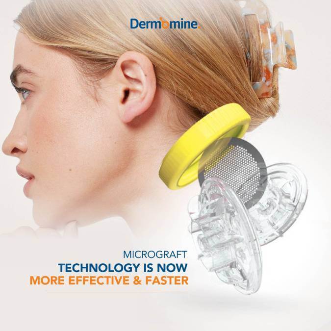 Dermomine-Microgaft (1)